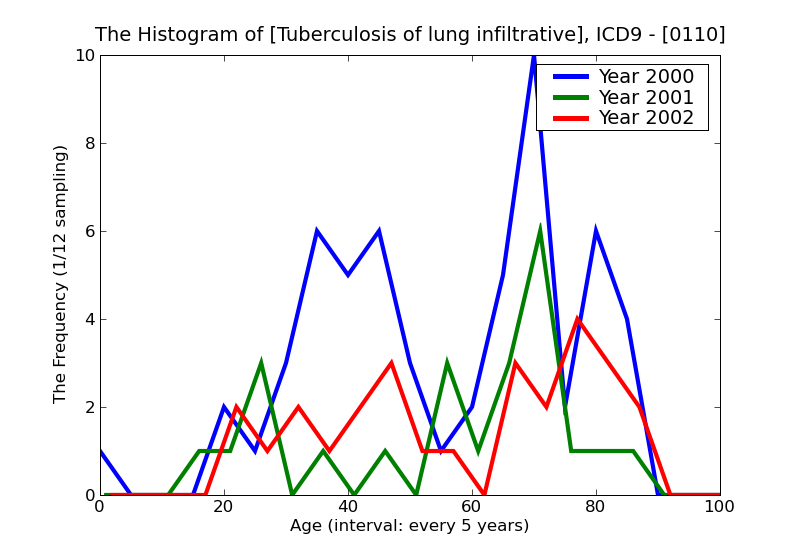ICD9 Histogram Tuberculosis of lung infiltrative