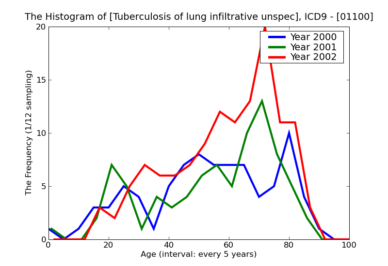 ICD9 Histogram Tuberculosis of lung infiltrative unspecified