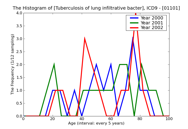 ICD9 Histogram Tuberculosis of lung infiltrative bacteriological or histological examination not done