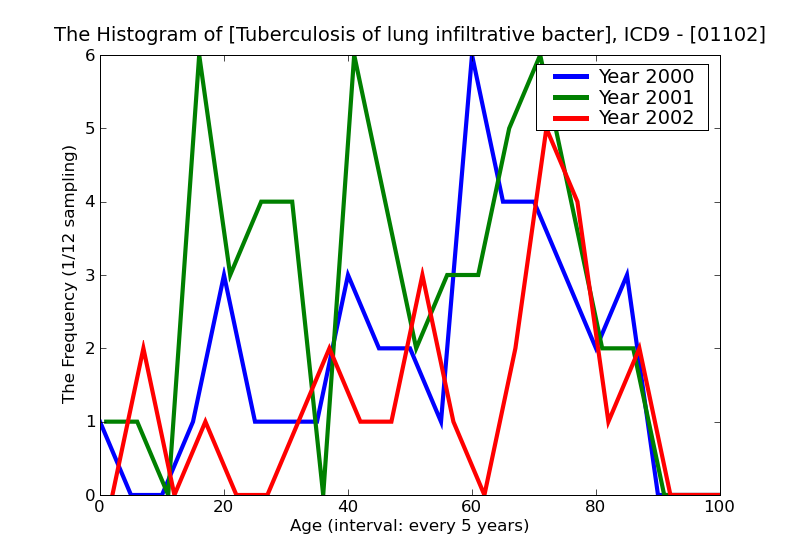 ICD9 Histogram Tuberculosis of lung infiltrative bacteriological or histological examination unknown (at present)