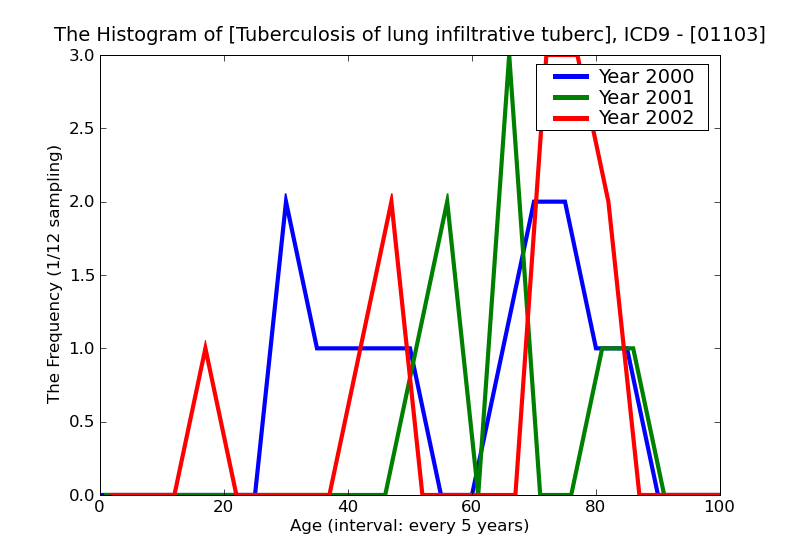 ICD9 Histogram Tuberculosis of lung infiltrative tubercle bacilli found (in sputum) by microscopy