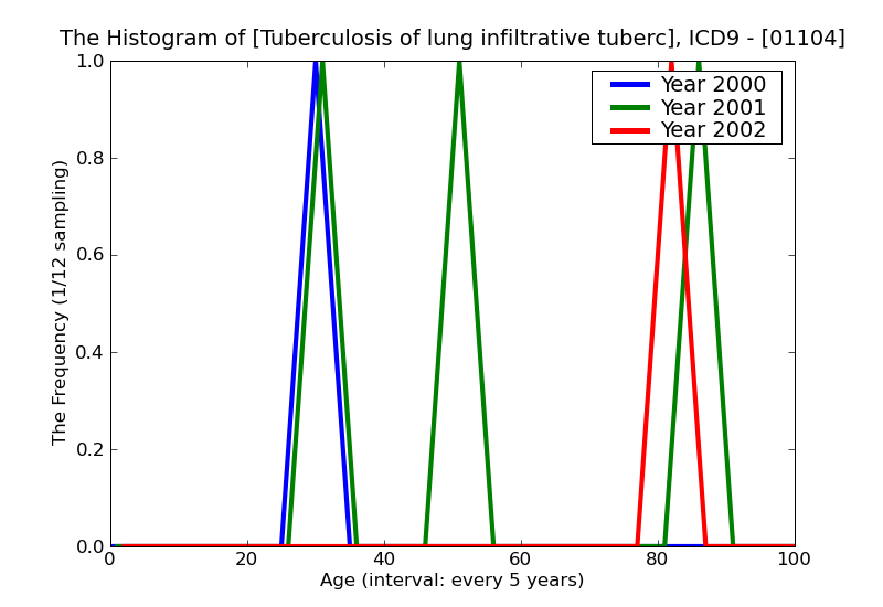 ICD9 Histogram Tuberculosis of lung infiltrative tubercle bacilli not found (in sputum) by microscopy but found by