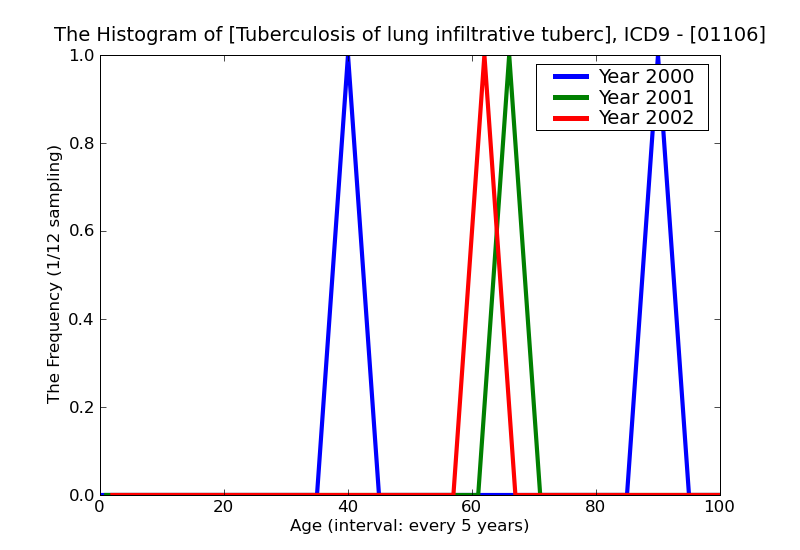 ICD9 Histogram Tuberculosis of lung infiltrative tubercle bacilli not found by bacteriological or histological exam