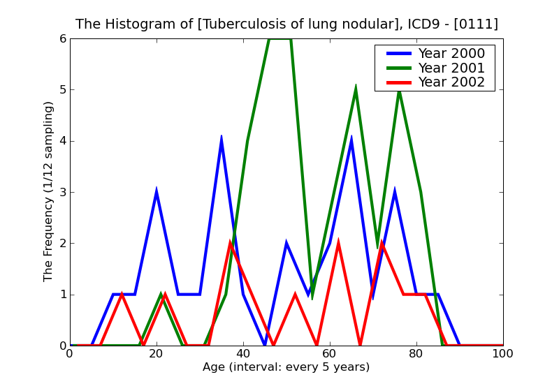 ICD9 Histogram Tuberculosis of lung nodular