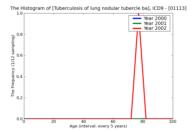 ICD9 Histogram Tuberculosis of lung nodular tubercle bacilli found (in sputum) by microscopy