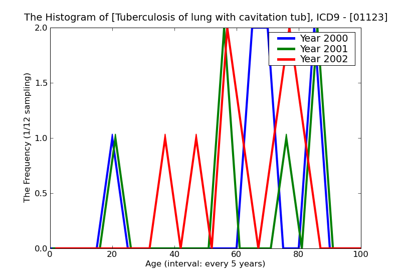 ICD9 Histogram Tuberculosis of lung with cavitation tubercle bacilli found (in sputum) by microscopy