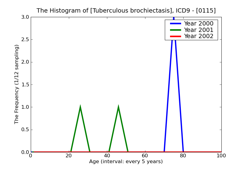 ICD9 Histogram Tuberculous brochiectasis