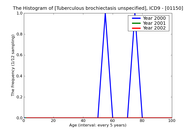 ICD9 Histogram Tuberculous brochiectasis unspecified
