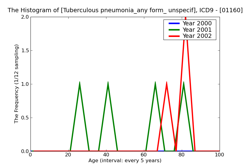 ICD9 Histogram Tuberculous pneumonia_any form_ unspecified