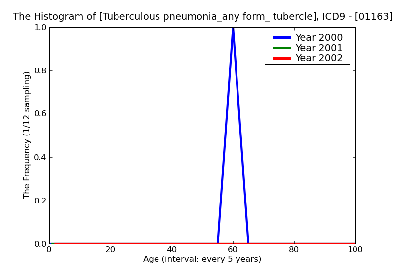 ICD9 Histogram Tuberculous pneumonia_any form_ tubercle bacilli found (in sputum) by microscopy