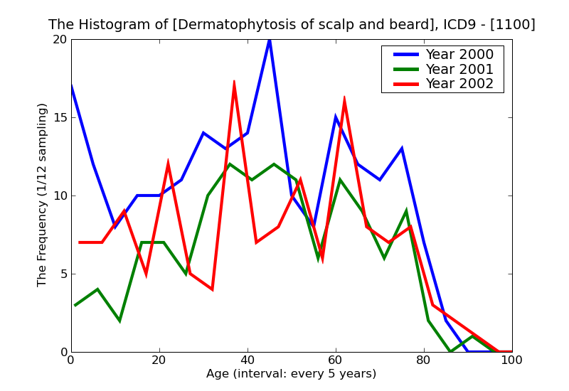 ICD9 Histogram Dermatophytosis of scalp and beard