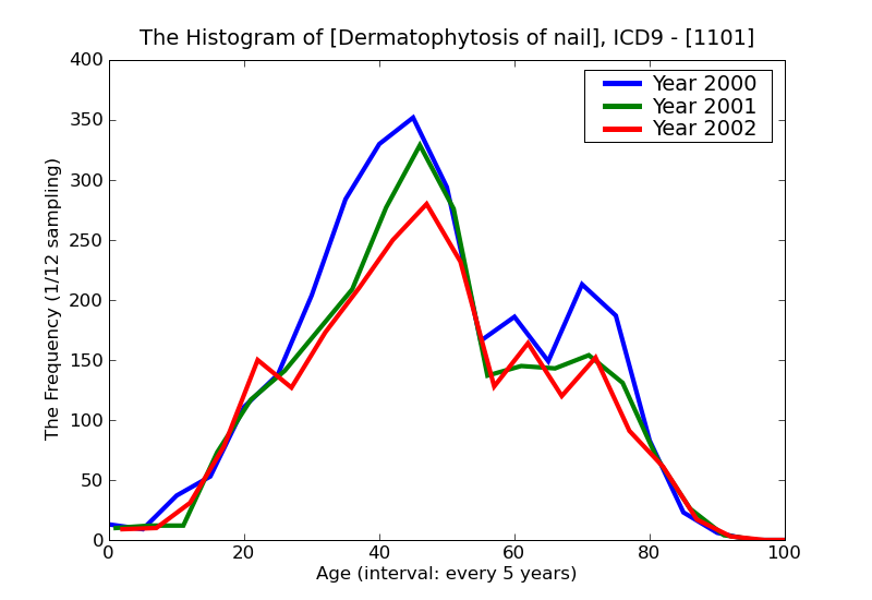 ICD9 Histogram Dermatophytosis of nail