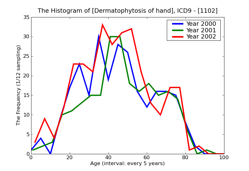 ICD9 Histogram Dermatophytosis of hand