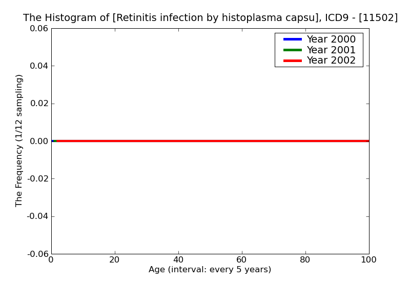 ICD9 Histogram Retinitis infection by histoplasma capsulatum