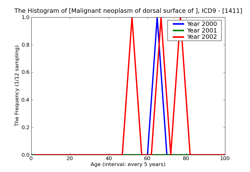 ICD9 Histogram Malignant neoplasm of dorsal surface of tongue
