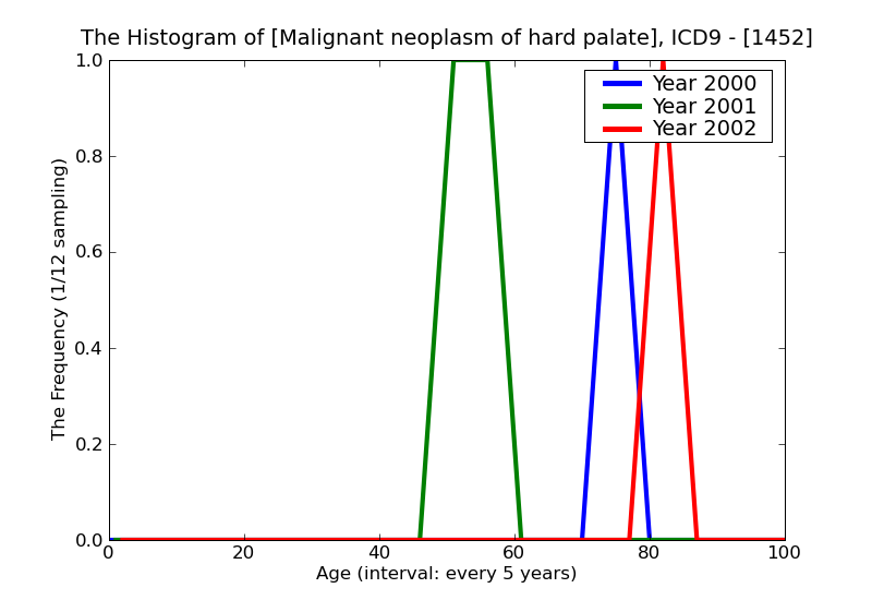 ICD9 Histogram Malignant neoplasm of hard palate