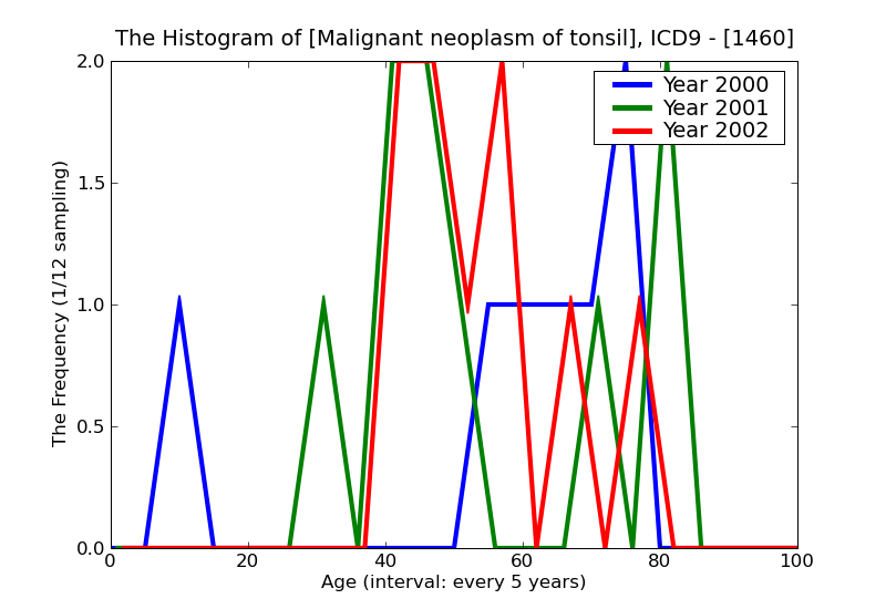 ICD9 Histogram Malignant neoplasm of tonsil