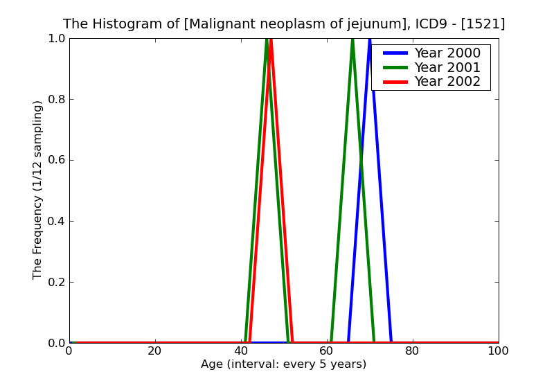 ICD9 Histogram Malignant neoplasm of jejunum