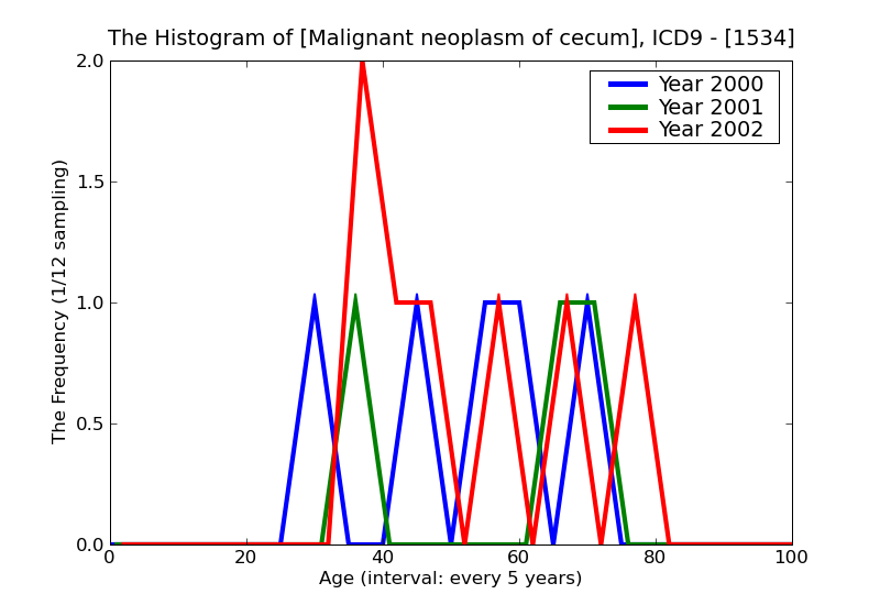 ICD9 Histogram Malignant neoplasm of cecum
