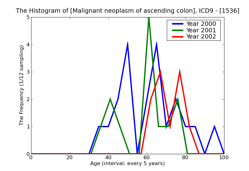 ICD9 Histogram Malignant neoplasm of ascending colon