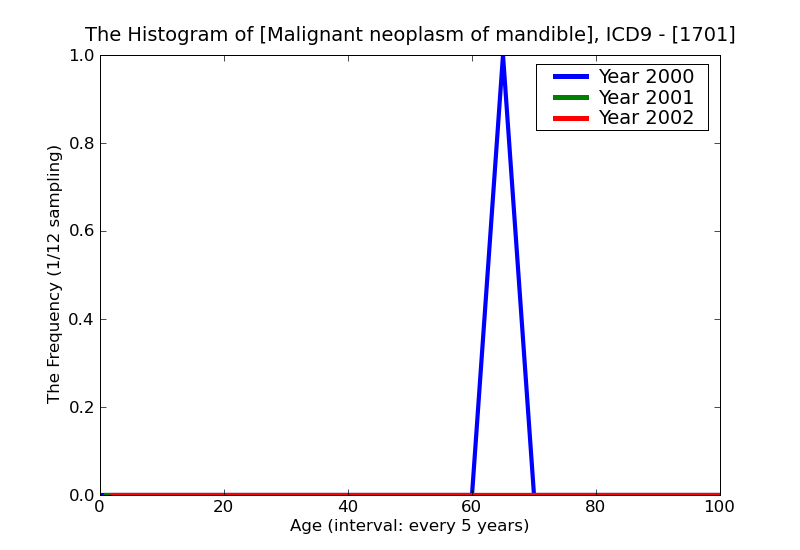 ICD9 Histogram Malignant neoplasm of mandible