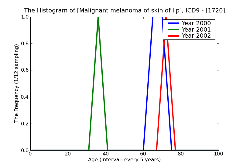 ICD9 Histogram Malignant melanoma of skin of lip