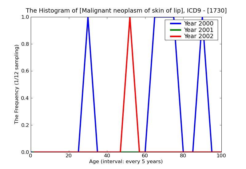 ICD9 Histogram Malignant neoplasm of skin of lip