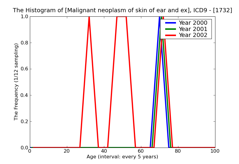 ICD9 Histogram Malignant neoplasm of skin of ear and external auditory canal