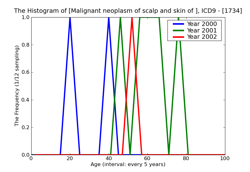 ICD9 Histogram Malignant neoplasm of scalp and skin of neck