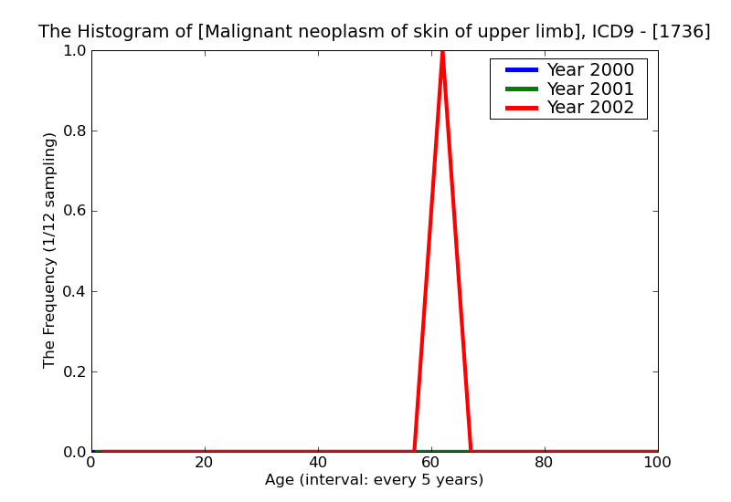 ICD9 Histogram Malignant neoplasm of skin of upper limb including shoulder