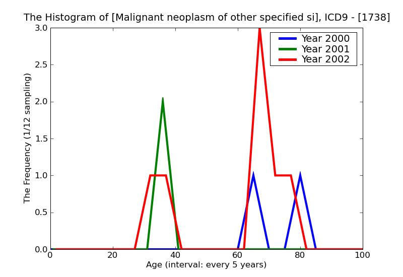 ICD9 Histogram Malignant neoplasm of other specified sites of skin