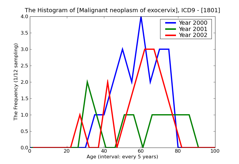 ICD9 Histogram Malignant neoplasm of exocervix