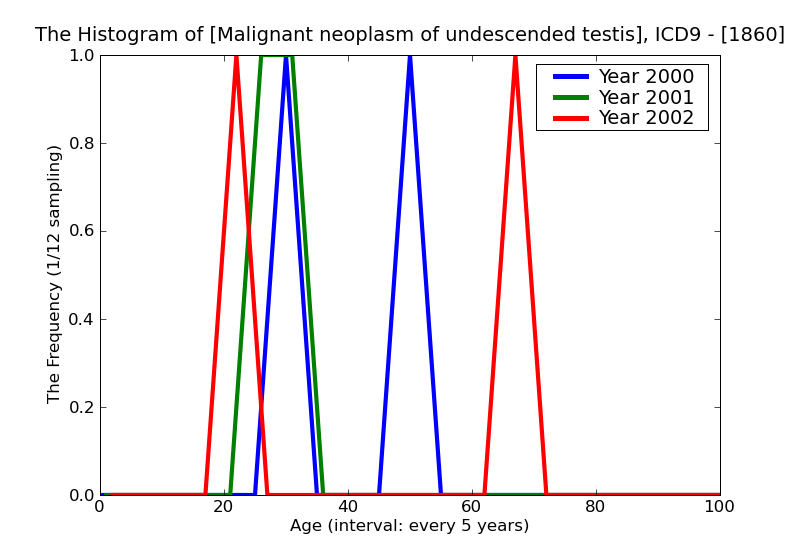 ICD9 Histogram Malignant neoplasm of undescended testis