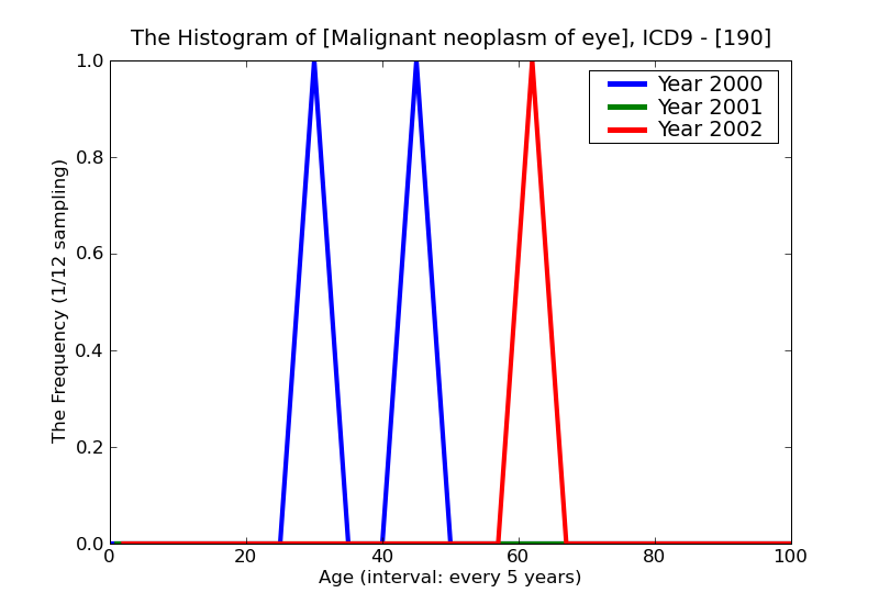 ICD9 Histogram Malignant neoplasm of eye