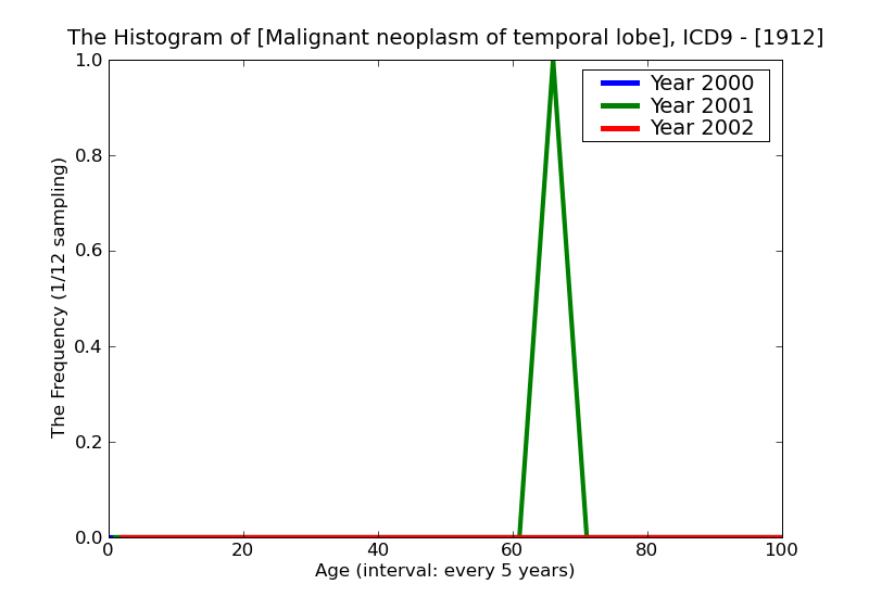 ICD9 Histogram Malignant neoplasm of temporal lobe