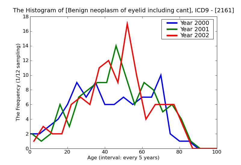 ICD9 Histogram Benign neoplasm of eyelid including canthus