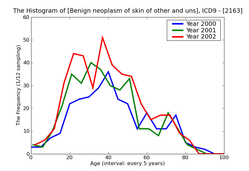 ICD9 Histogram Benign neoplasm of skin of other and unspecified parts of face