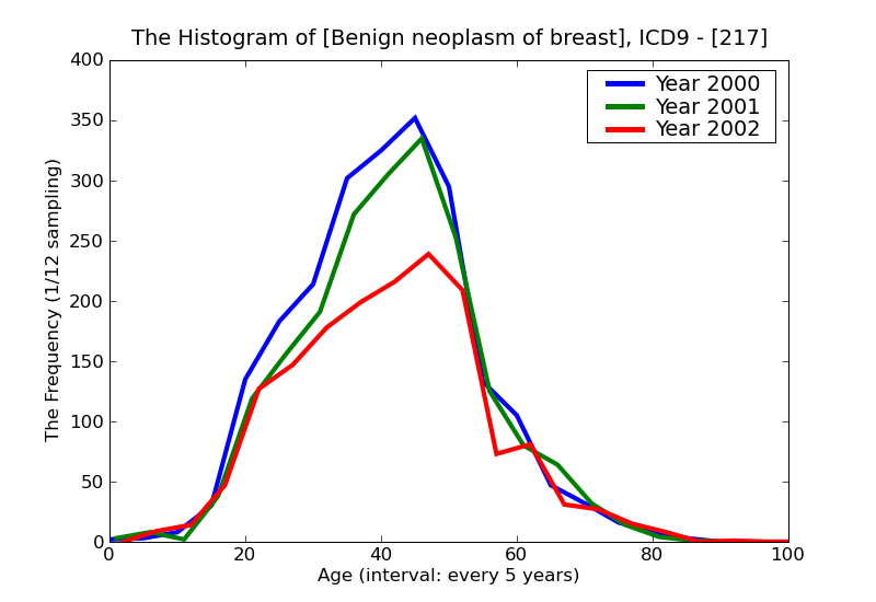 ICD9 Histogram Benign neoplasm of breast