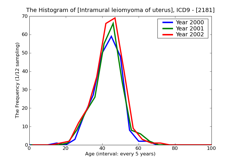 ICD9 Histogram Intramural leiomyoma of uterus