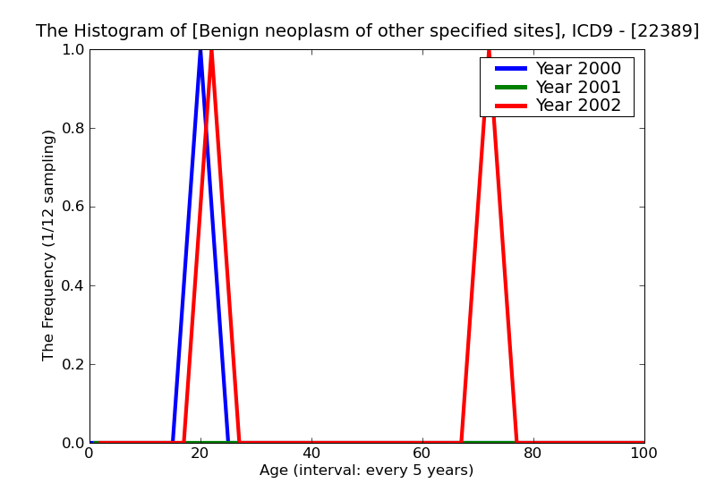 ICD9 Histogram Benign neoplasm of other specified sites of urinary organs