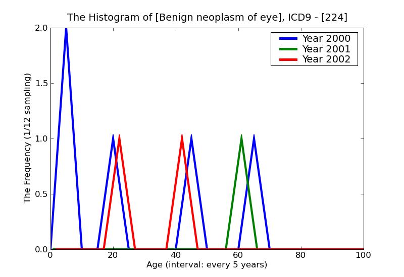ICD9 Histogram Benign neoplasm of eye