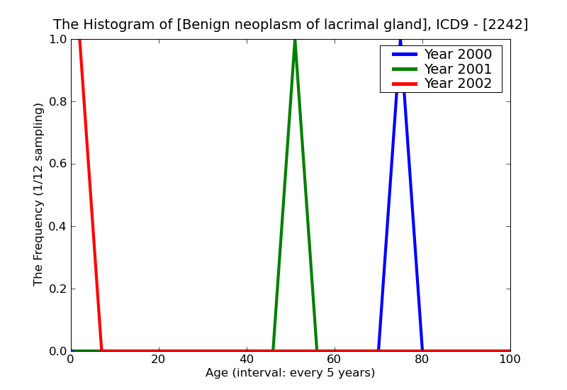 ICD9 Histogram Benign neoplasm of lacrimal gland