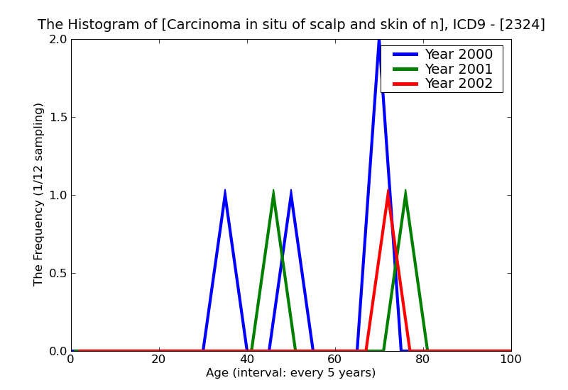 ICD9 Histogram Carcinoma in situ of scalp and skin of neck