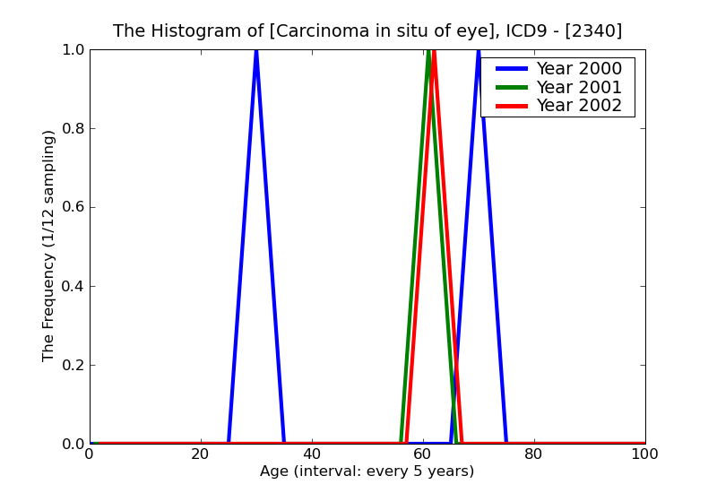 ICD9 Histogram Carcinoma in situ of eye