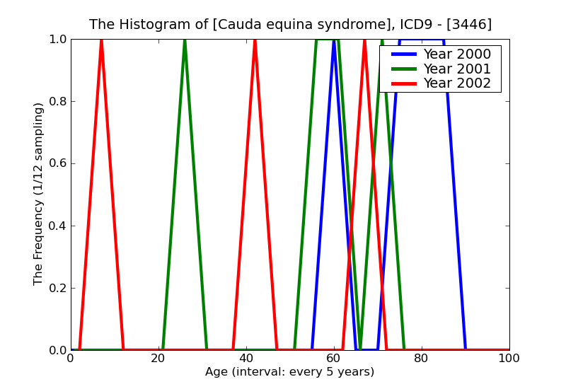 ICD9 Histogram Cauda equina syndrome