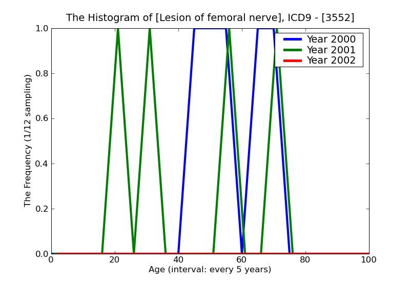 ICD9 Histogram Lesion of femoral nerve