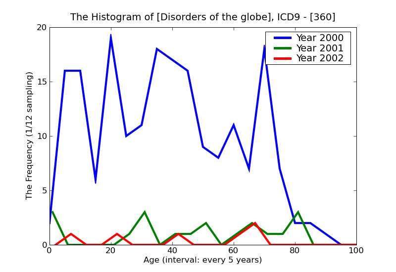 ICD9 Histogram Disorders of the globe