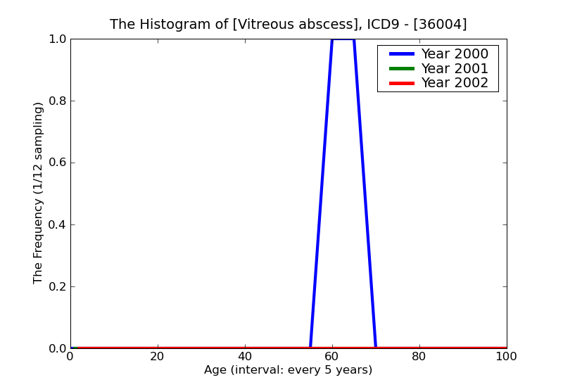 ICD9 Histogram Vitreous abscess
