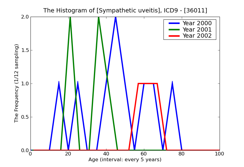 ICD9 Histogram Sympathetic uveitis