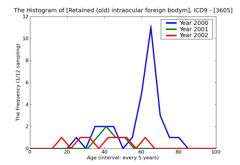 ICD9 Histogram Retained (old) intraocular foreign bodymagnetic